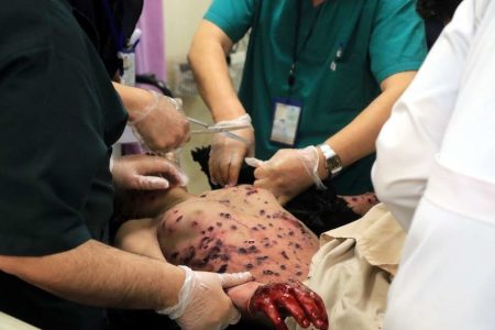 چهارشنبه آخر سال با۶۹ مصدوم در گیلان به پایان رسید