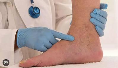 لخته‌هایی که خطر مرگ در پی دارند