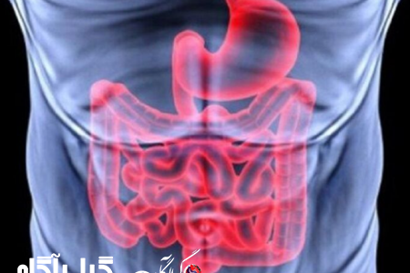 نخستین جراحی کم‌تهاجمی درمان تومورهای معده در مشهد انجام شد