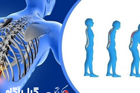 چگونه می‌توان از پوکی استخوان جلوگیری کرد؟