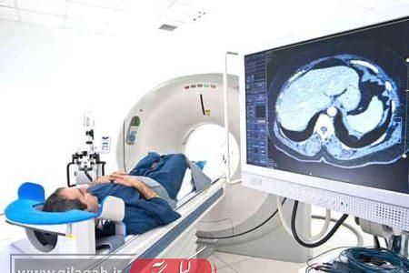 تکنولوژی جدید تشخیص انواع سرطان در راه گیلان